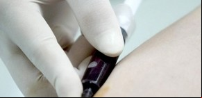 Aprueban un cóctel de drogas para curar la hepatitis C