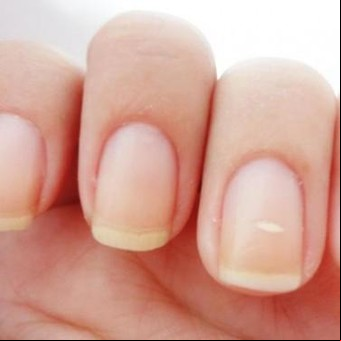 Por qué aparecen esas "odiosas" manchitas blancas en las uñas