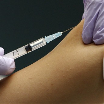 HPV y cáncer de cuello de útero: la prevención es la clave 