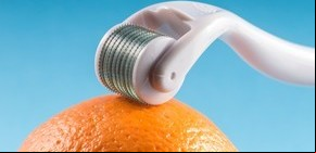 Contra la celulitis: tratamientos, cremas y cuidados indispensables