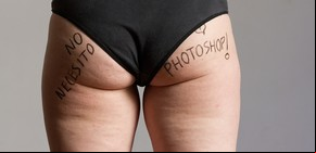Celulitis a pleno: las argentinas se sumaron al #cellulitesaturday