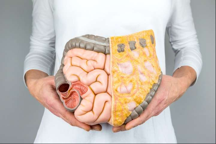 Cáncer de colon