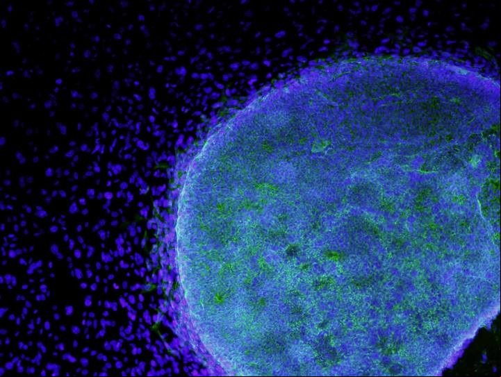 Una imagen de microscopio que muestra células madre embrionarias en pleno crecimiento (REUTERS/Alan Trounson/California Institute for Regenerative Medicine).
