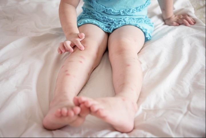 Laurel y sal también funcionan como repelentes de mosquitos y otros insectos.