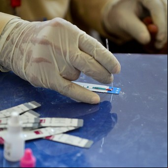 Lanzan el primer autotest para diagnosticar VIH en el país 
