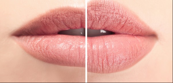 Cómo curar los labios secos y agrietados con remedios simples