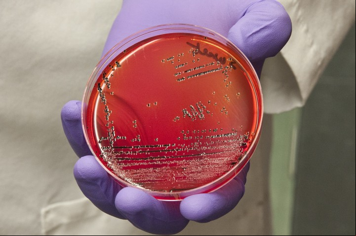 La hierba tendría un efecto antibiótico contra bacterias como la salmonella, que aquí se muestra. Foto: Michael J. Ermarth/U.S. Food and Drug istration