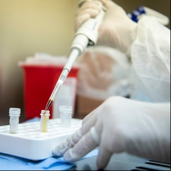 Coronavirus en Argentina: los "falsos negativos" en los tests, una debilidad más frente a la pandemia