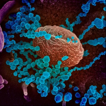 Coronavirus: el día que le vimos la cara al "monstruo"