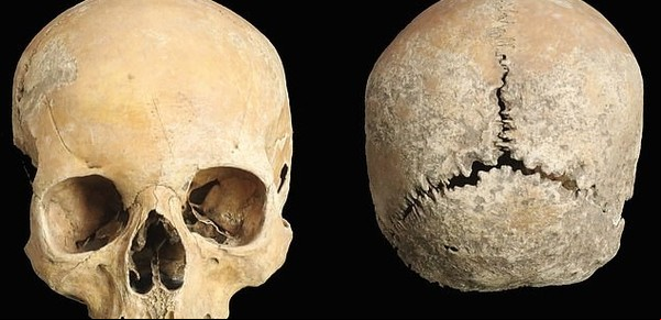 Brutal: en Inglaterra, al que rompía la ley, le rompían la cabeza
