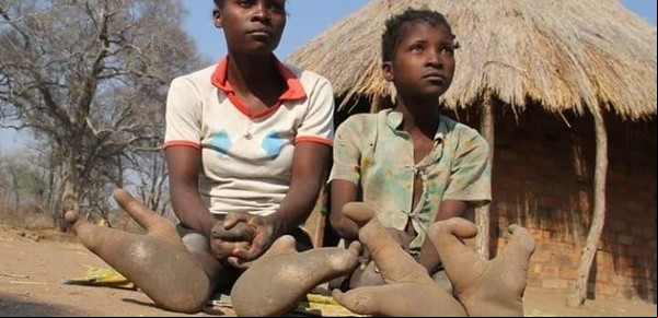 Vadoma: la misteriosa tribu africana cuyos tienen "pies de avestruz"