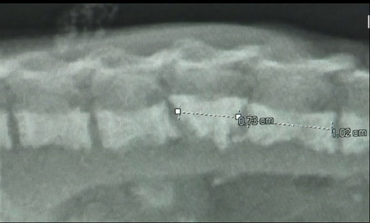 Las radiografías mostraron que el bebé tiene la columna rota (Captura de video).