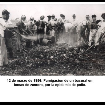 Polio en la Argentina: cómo se vivió la terrible epidemia de los años '50