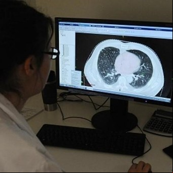 Salud cambió el sistema para acceder a medicamentos oncológicos: cómo es ahora el trámite 