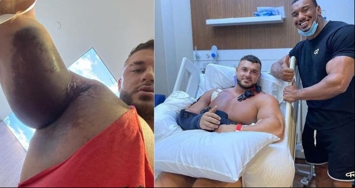 La lesión en su brazo derecho y su recuperación, ya operado.