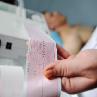 Qué enfermedades pueden salir en un electrocardiograma