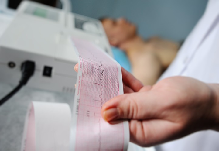 El diagnóstico se confirma mediante electrocardiograma. Foto Shutterstock.