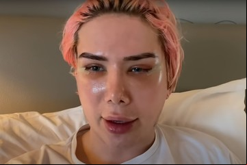 Amenazan de muerte a influencer "transracial" que se operó para parecerse a un cantante de BTS
