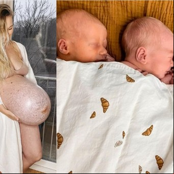La mamá que asombró en las redes con su panza de trillizos