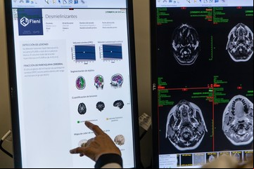 "Doctor algoritmo": cómo funcionan los servicios de salud asistidos por inteligencia artificial
