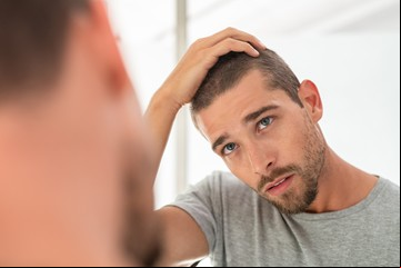 Alopecia: qué se puede hacer para frenar la caída de pelo, incluso si hay predisposición genética