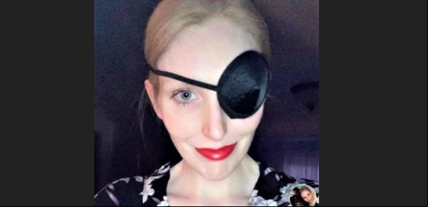 Le inyectaron bótox por las migrañas y quedó ciega de un ojo: "Confié en el neurólogo"