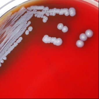 Detectan por primera vez un tipo de bacteria potencialmente mortal en EE.UU.