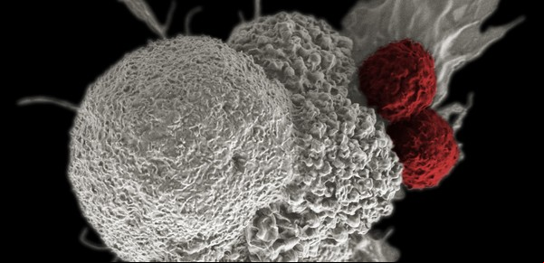 Jaque al cáncer: las claves de una terapia con resultados alentadores
