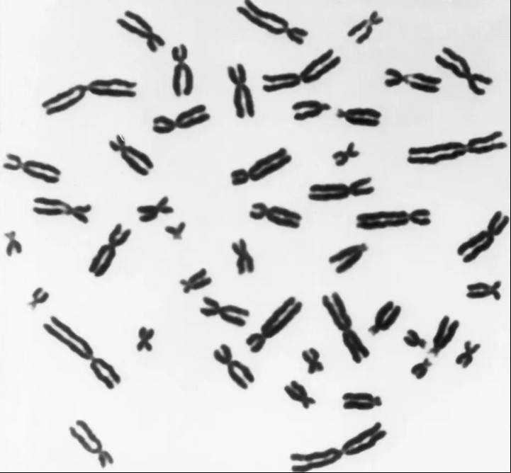 Por lo general, los fragmentos de genes adicionales o faltantes son fatales para los embriones, y los fetos que sobreviven con ellos a menudo tienen defectos de nacimiento graves. Foto Biophoto Associates/Science Source