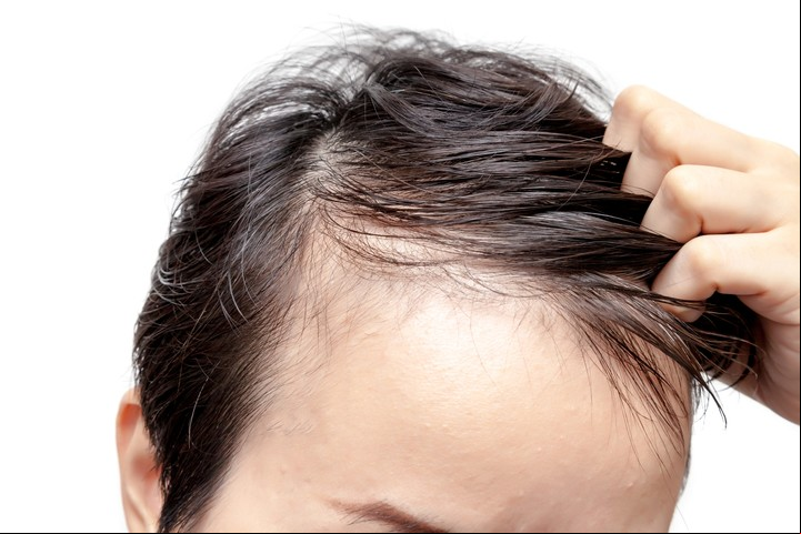 Algunos tratamientos consisten en istrar sustancias que bloquean la acción de las hormonas masculinas. Foto Shutterstock.