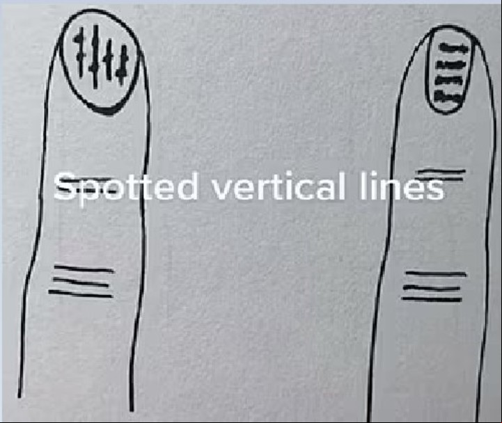 Marcas verticales para estar atentos.