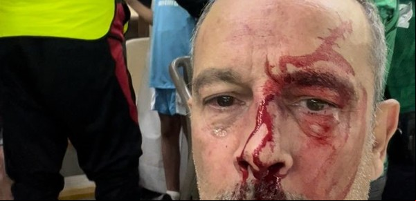 Hablan los hinchas argentinos que fueron golpeados por mexicanos durante el partido en Qatar: "Nos fueron a buscar"