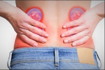¿Cuáles son los síntomas de cálculos en los riñones?