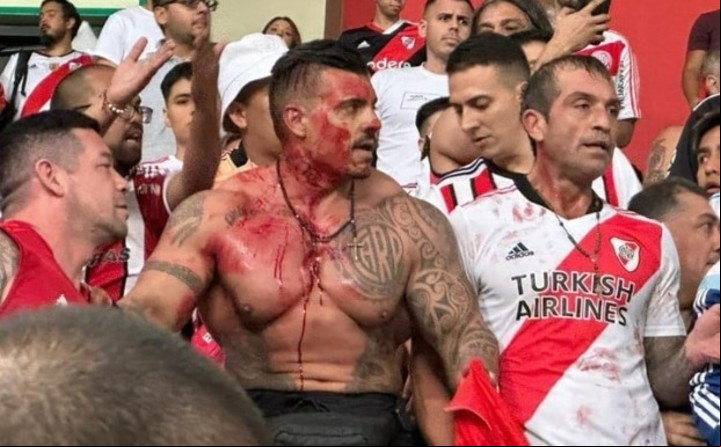 Ariel Calvici, uno de los referentes de la barra de River, ensangrentado en Lima.