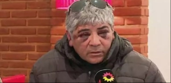 "Fueron a matarme": el crudo relato de Hugo, agredido brutalmente por los patovicas en Necochea