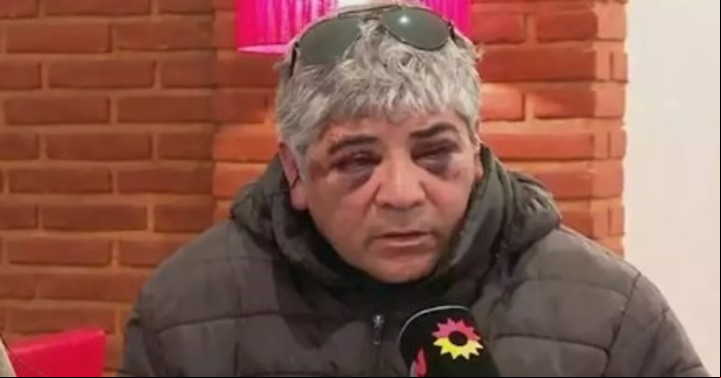 "Fueron a matarme": el crudo relato de Hugo, uno de las agredidos brutalmente por los patovicas en Necochea