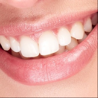 Tres alimentos que ayudan a blanquear los dientes de forma natural