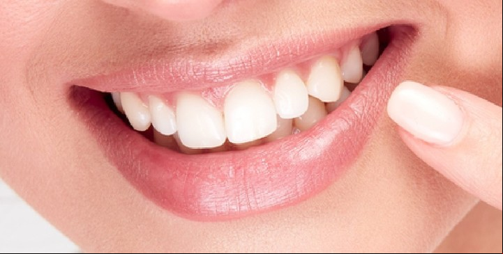 La obsesión por tener dientes excesivamente blancos. Foto ilustrativa