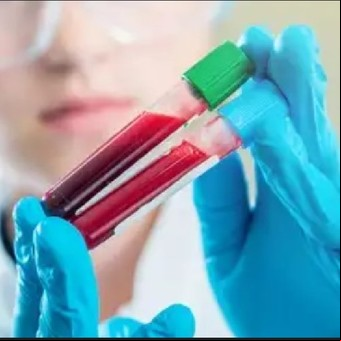 Cuáles son las ventajas y problemas poco conocidos de tener tipo de sangre 0 positivo y negativo