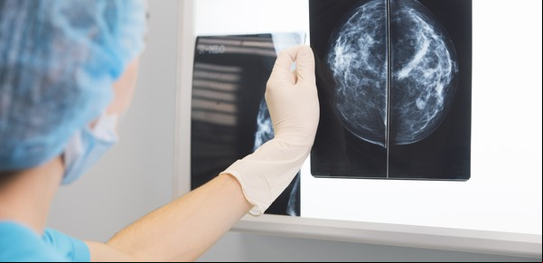 Una droga contra el cáncer muy usada en el país tuvo una abrupta caída del precio en enero: la curiosa causa