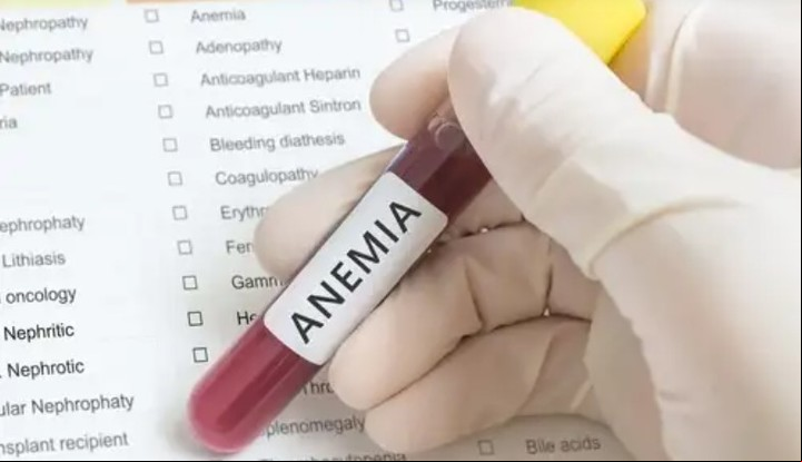 La anemia es más común en el grupo A+.