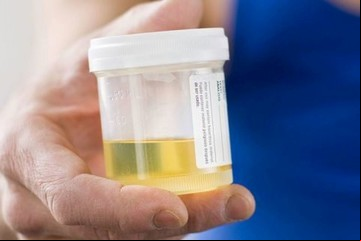 La ciencia revela un misterio de 125 años: qué causa el color amarillo del pis 