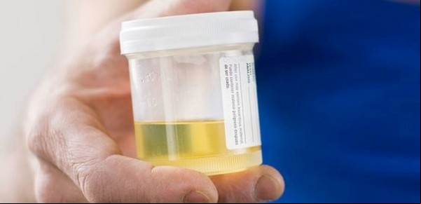 La ciencia revela un misterio de 125 años: qué causa el color amarillo del pis