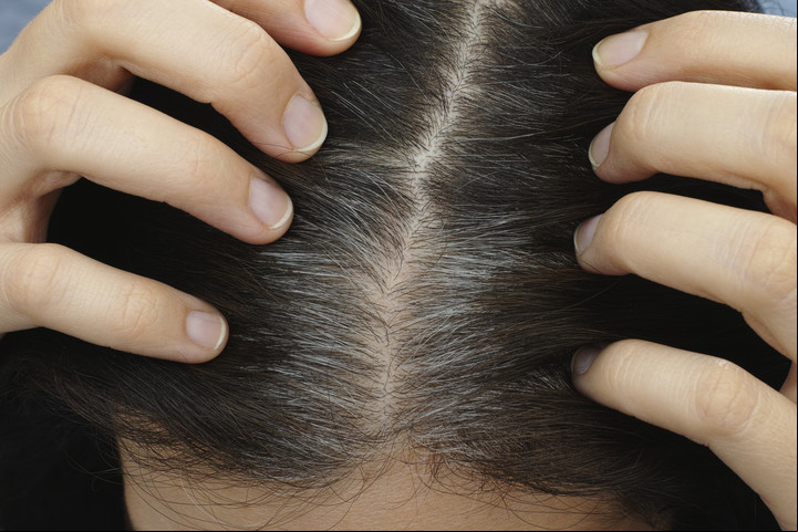 Los preparados con jengibre y aceite de oliva matizan las canas incipientes Foto: Shutterstock.
