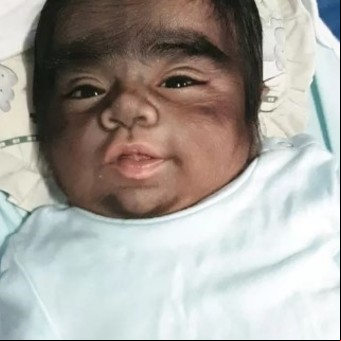 Madre desesperada: "mi bebé se parece a un hombre lobo y es culpa mía porque comí un gato estando embarazada"