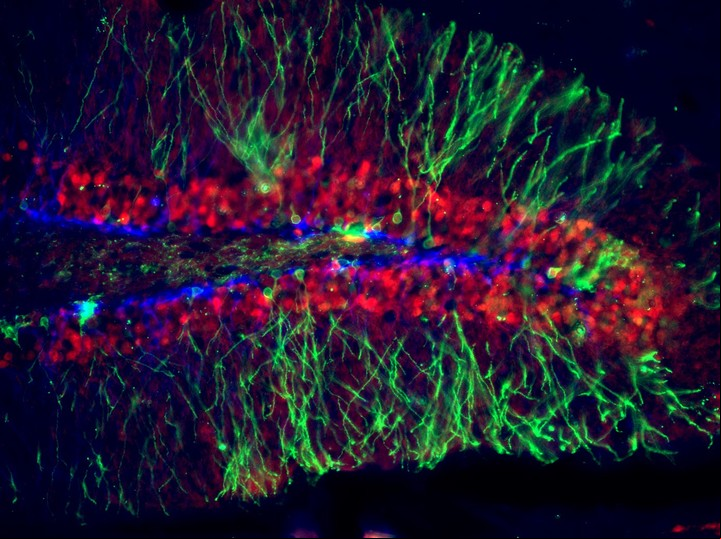 Neuronas del hipocampo del cerebro tomadas por el Laboratorio de Fisiología y Algoritmos del Cerebro, del Instituto Leloir-Conicet.