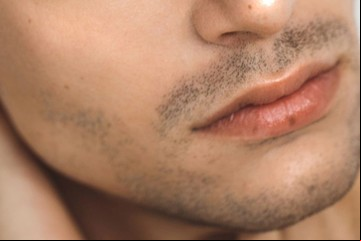 El tratamiento de rejuvenecimiento facial que es tendencia entre los hombres y se resuelve en 15 minutos