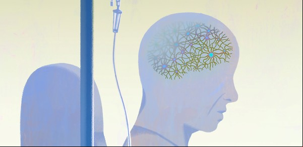 Por fin está disponible un medicamento para frenar el alzhéimer. ¿Cómo les va a los pacientes?