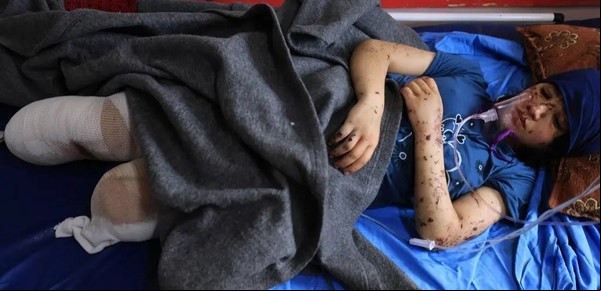 "Un paisaje infernal": Las terribles condiciones de Gaza dejan multitud de amputados