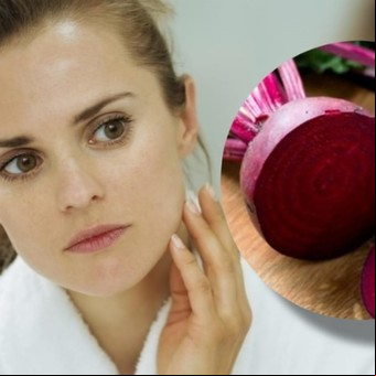Cómo usar la remolacha para quitar las manchas de la cara